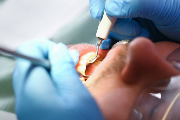 Best Pediatric Emergency Dentist in Ellenville, NY